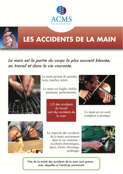 Prévention des accidents de la main au travail