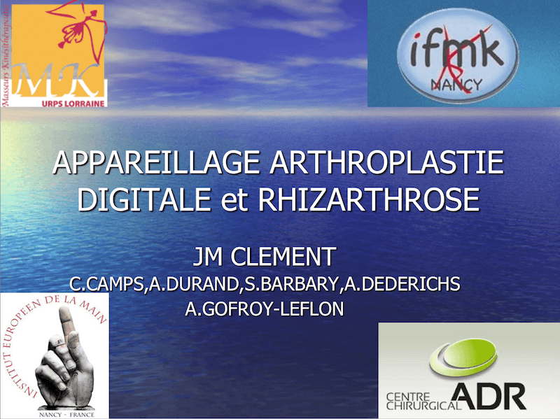 appareillage de la rhizarthrose