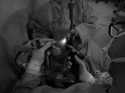 Arthroscopie du poignet