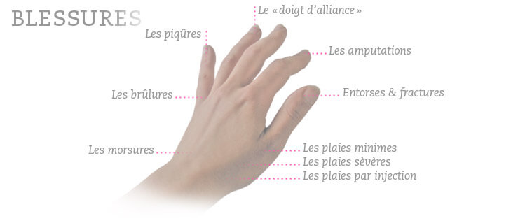Lien vers accidentsmain.fr Lien vers accidentsmain.fr