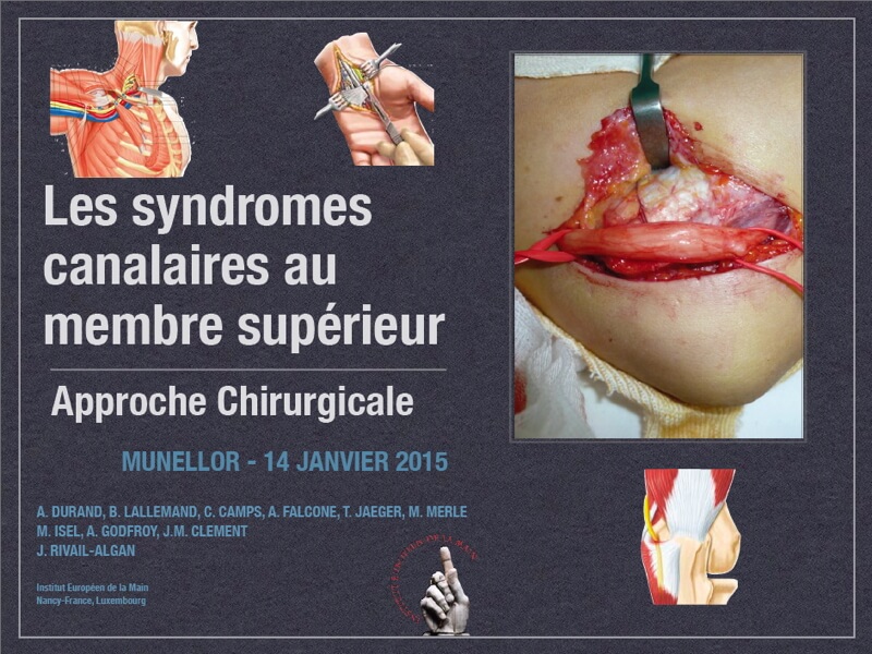 syndromes canalaires du membre supérieur